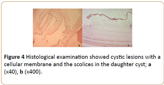 insights-in-reproductive-medicine-cystic-lesions