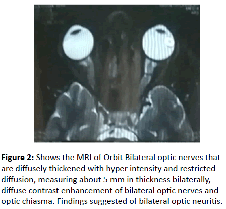 international-journal-Orbit-Bilateral