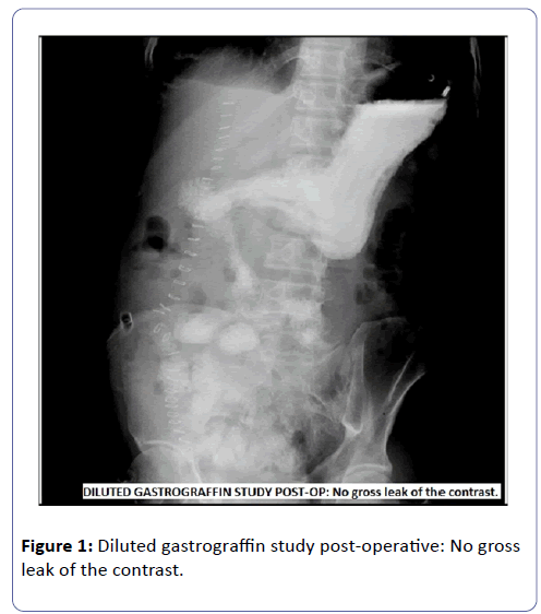 international-journal-case-reports-Diluted-gastrograffin