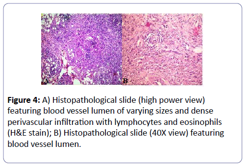 international-journal-case-reports-Histopathological-slide