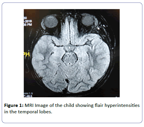 international-journal-case-reports-MRI-Image