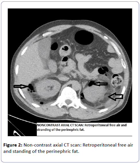 international-journal-case-reports-Non-contrast