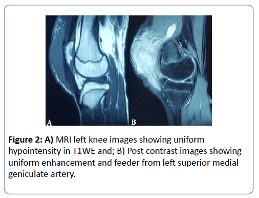 international-journal-case-reports-Post-contrast