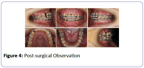 international-journal-case-reports-Post-surgical