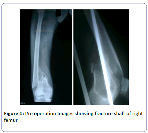 international-journal-case-reports-Pre-operation