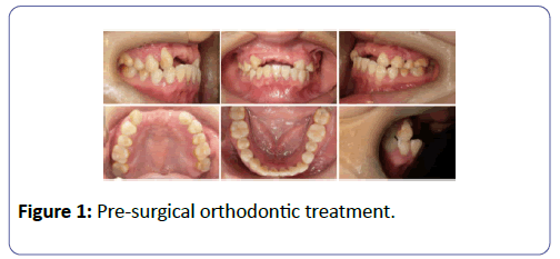 international-journal-case-reports-Pre-surgical
