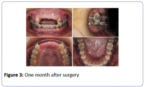 international-journal-case-reports-after-surgery