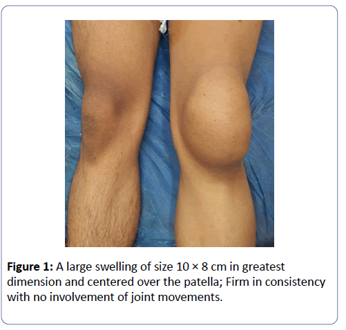 international-journal-case-reports-large-swelling