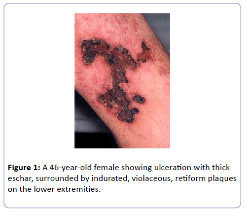 international-journal-case-reports-lower-extremities