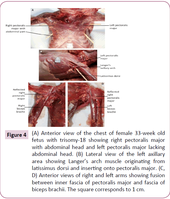 journal-anatomical-science-research-Anterior-view