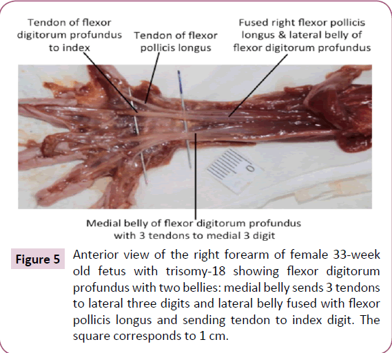 journal-anatomical-science-research-lateral-belly