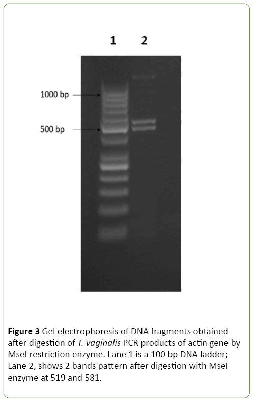 journal-molecular-microbiology-electrophoresis