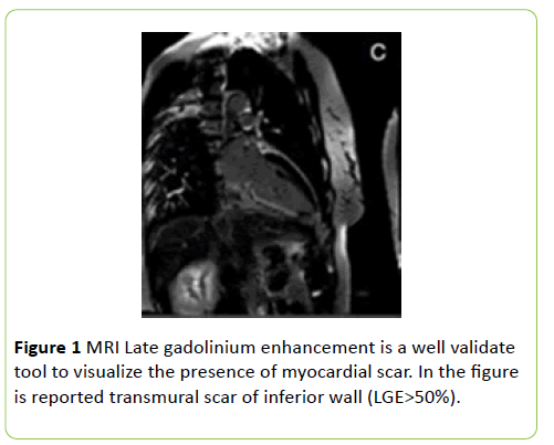 medical-clinical-reviews-myocardial-scar