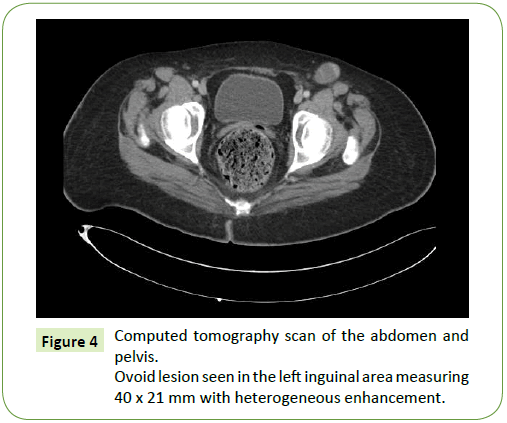 medical-oncology-abdomen