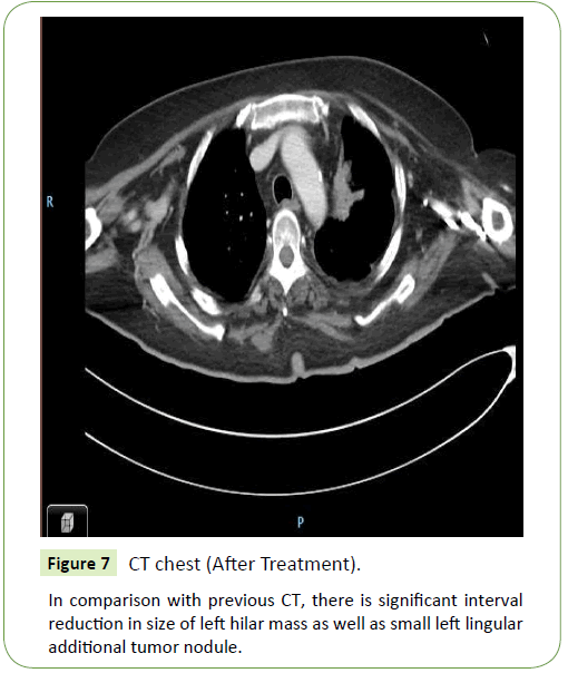 medical-oncology-chest