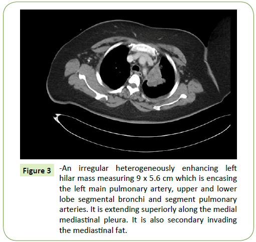 medical-oncology-heterogeneously