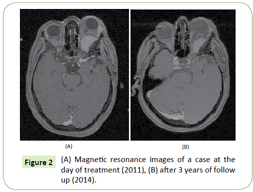 medical-oncology-resonance