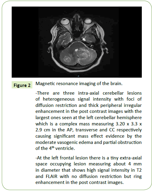 medical-oncology-resonance