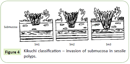 medical-oncology-submucosa