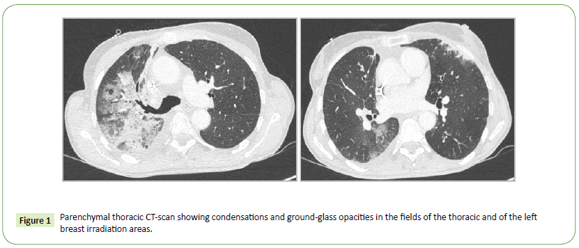 medical-oncology-thoracic