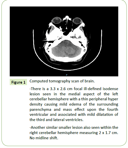 medical-oncology-tomography