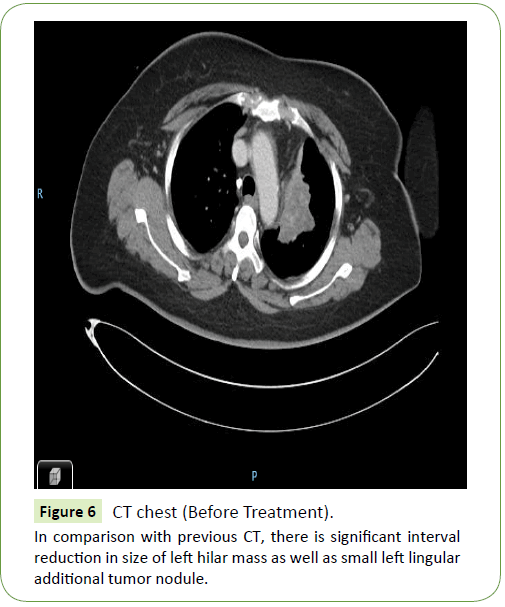 medical-oncology-treatment