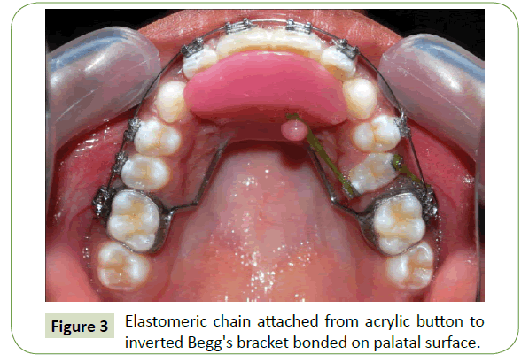 medical-research-health-education-Elastomeric-chain