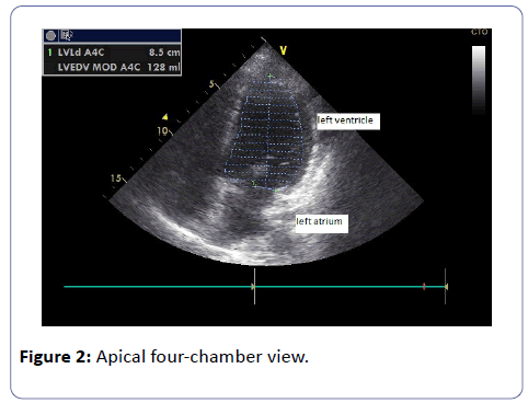 medicine-therapeutics-Apical-four