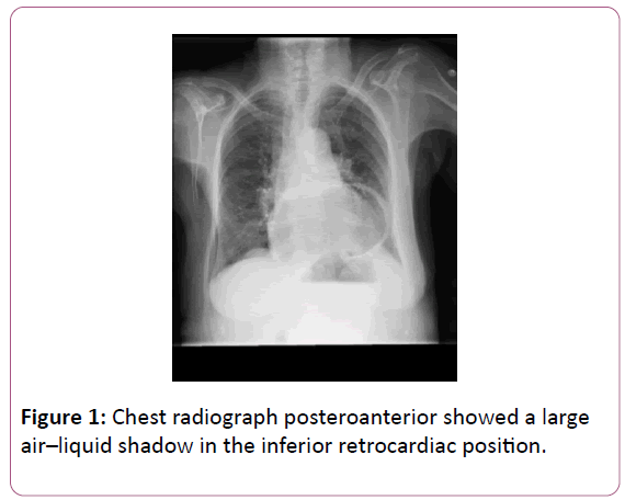 medicine-therapeutics-Chest-radiograph