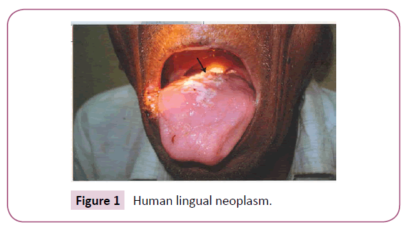 medicine-therapeutics-Human-lingual