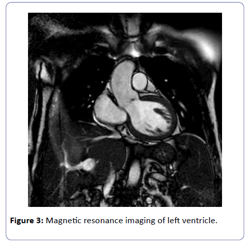 medicine-therapeutics-Magnetic-resonance