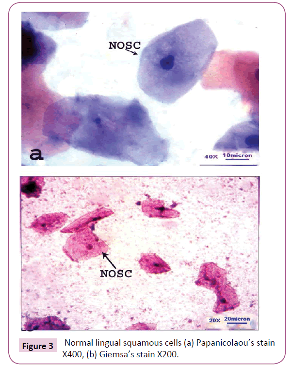 medicine-therapeutics-Normal-lingual