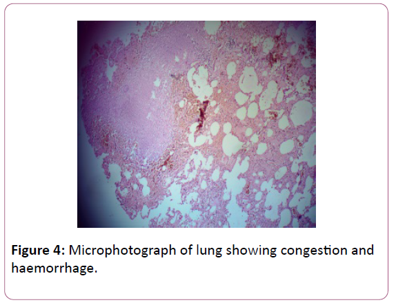 medicine-therapeutics-congestion