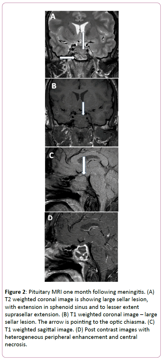 medicine-therapeutics-coronal-image