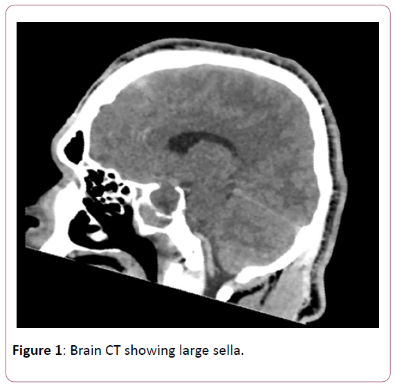 medicine-therapeutics-large-sella