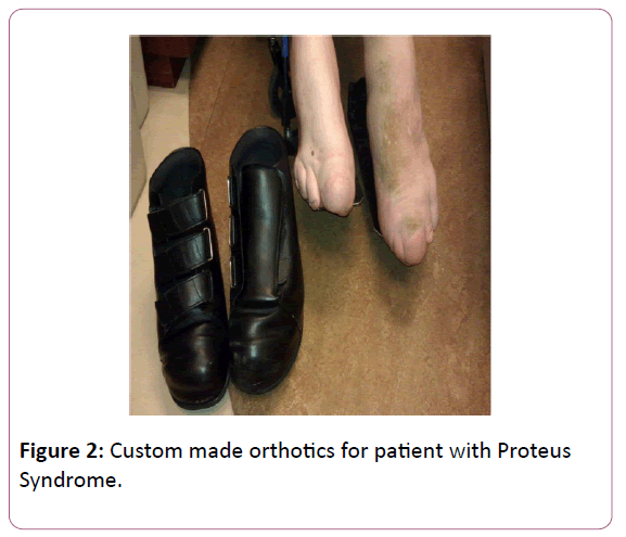 medicine-therapeutics-made-orthotics