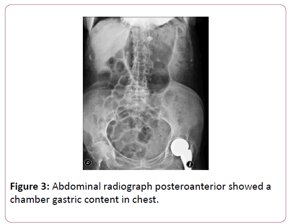 medicine-therapeutics-posteroanterior