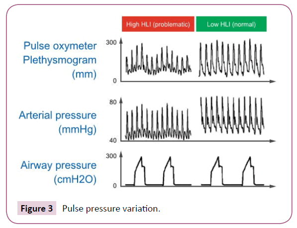 medicine-therapeutics-pressure-variation