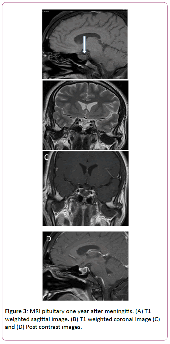 medicine-therapeutics-sagittal-image