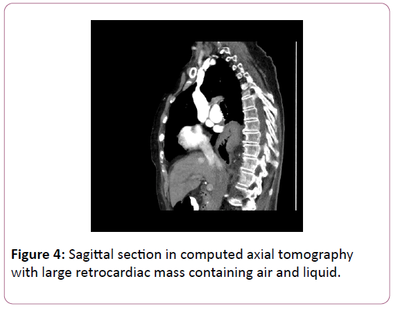 medicine-therapeutics-tomography