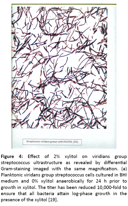 microbiology-immunology-research-streptococcus-ultrastructure