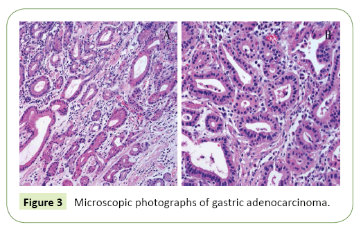 molecular-biology-and-biotechnology-adenocarcinoma