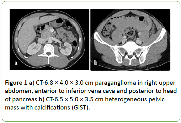 molecular-genetics-medicine-paraganglioma