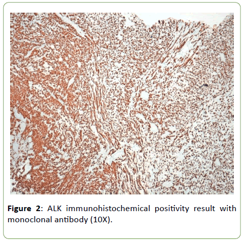 molecular-sciences-immunohistochemical