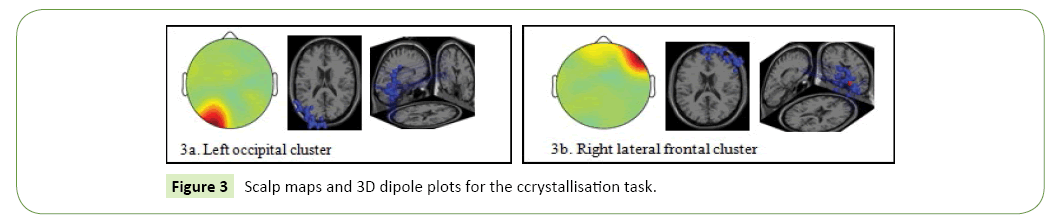 neurological-science-journal-ccrystallisation