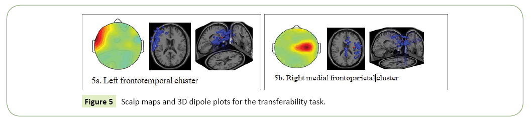 neurological-science-journal-dipole