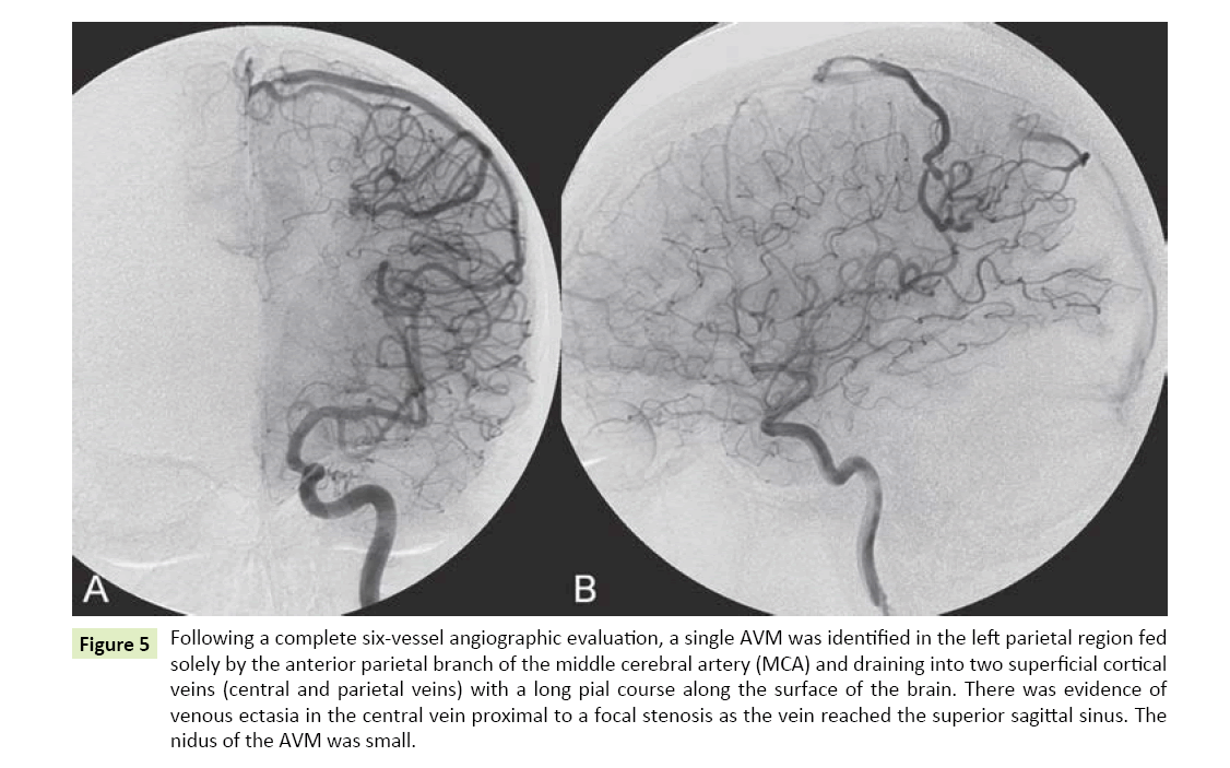 neurological-science-six-vessel-angiographic