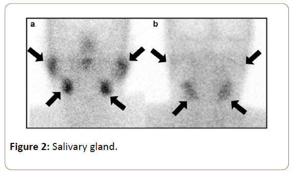 oncopathology-clinical-research-Salivary-gland