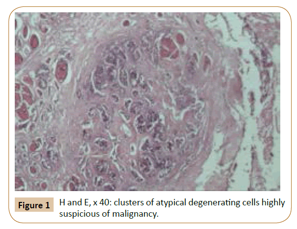 oncopathology-clinical-research-clusters-atypical