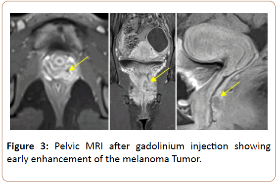 oncopathology-clinical-research-gadolinium-injection